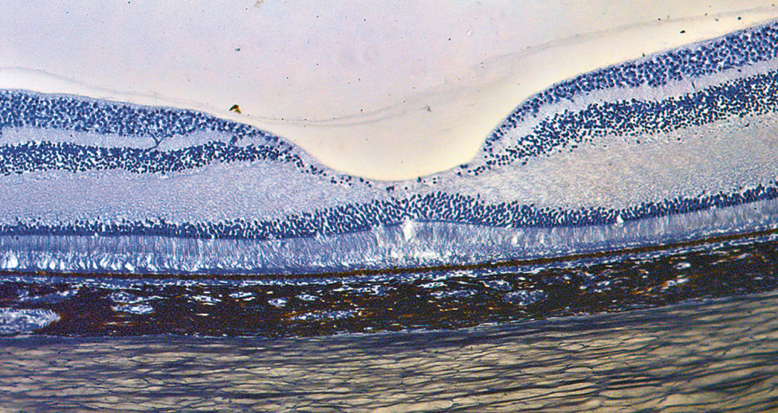 Vue en microscopie d’une fovéa.
